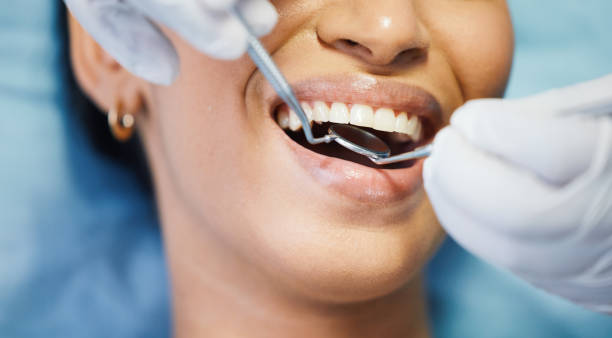 Best Emergency Dental Care for Sports Injuries in Shady Shores, TX